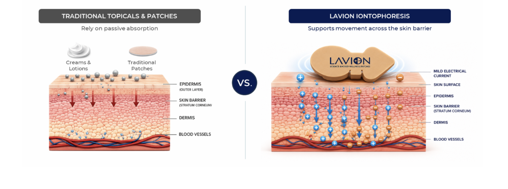 Infographic: The skin barrier challenge — traditional topicals versus LavION iontophoresis
